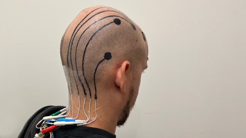 Electronic ‘tattoos’ offer an alternative to electrodes for brain monitoring