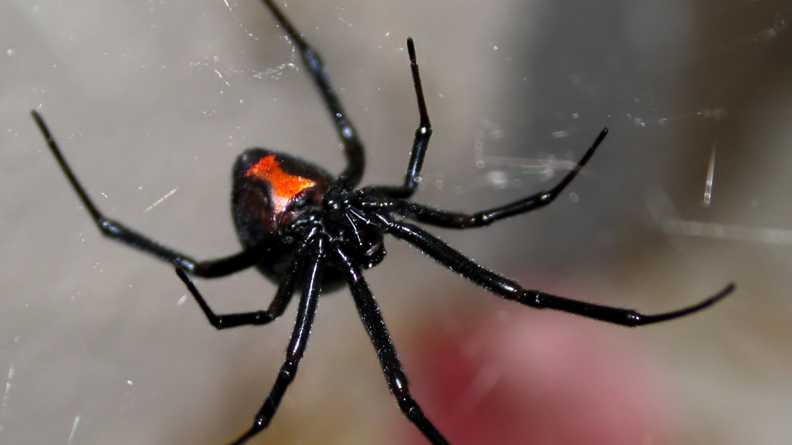 Diagnostic dilemma: A woman injected herself with venom from a black widow spider