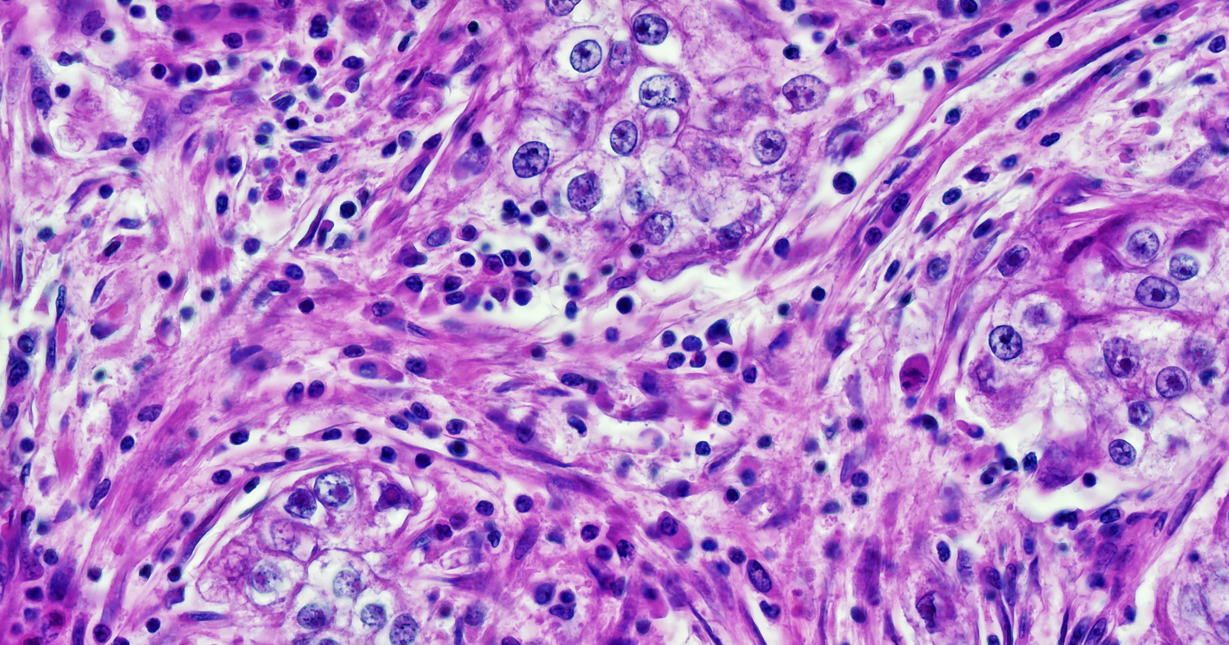 Ai Cancer Diagnostic Bias Lkvogf