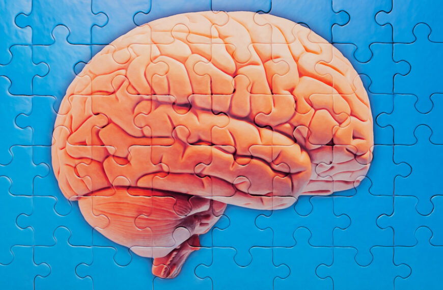 Northwestern University Possible Alzheimers Kljvjf