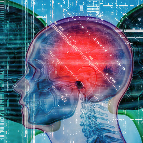 Man Gets Clean Bill of Health From Super-Expensive MRI Scan, Then Gets Horrible News