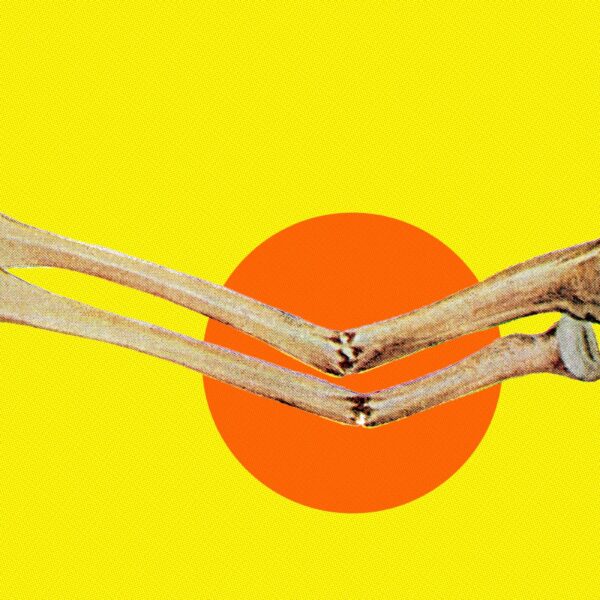 Atmospheric CO2 Getting So High That It’s Weakening Human Skeletons