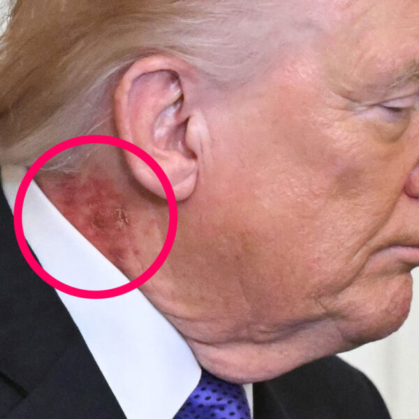White House Responds as Scabby Mark Appears on&hellip;