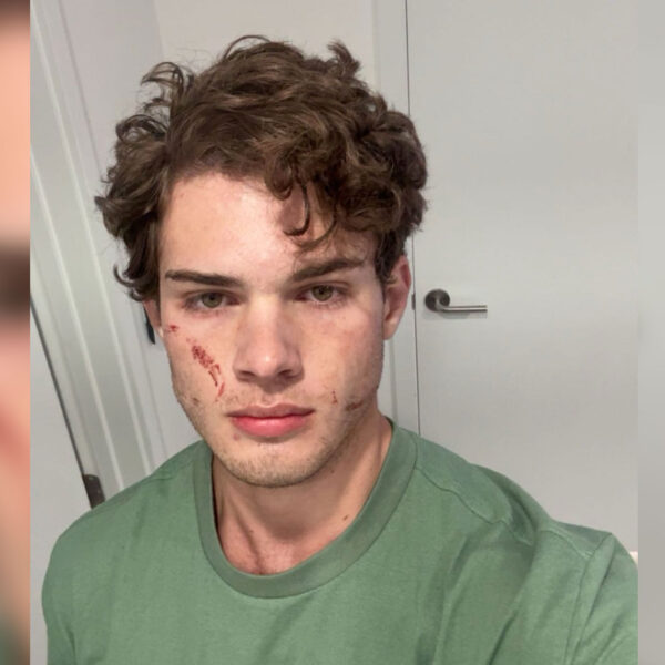 Clavicular Rushed to Hospital in Perfect Illustration of Why Looksmaxxing Is a Horrifying Death Cult