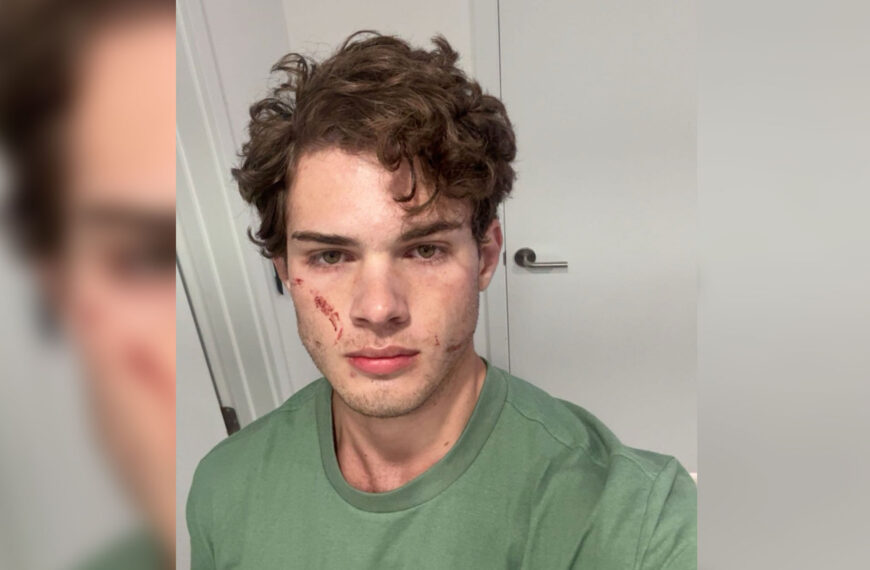 Clavicular Rushed to Hospital in Perfect Illustration of Why Looksmaxxing Is a Horrifying Death Cult