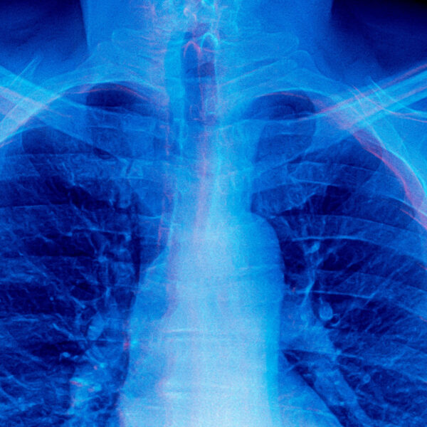 Frontier AI Models Are Doing Something Absolutely Bizarre When Asked to Diagnose Medical X-Rays