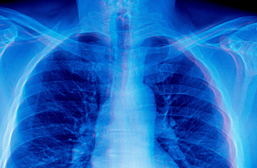 Frontier AI Models Are Doing Something&hellip;