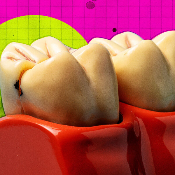 Plans Accelerated for Human Trials of Tooth Regeneration