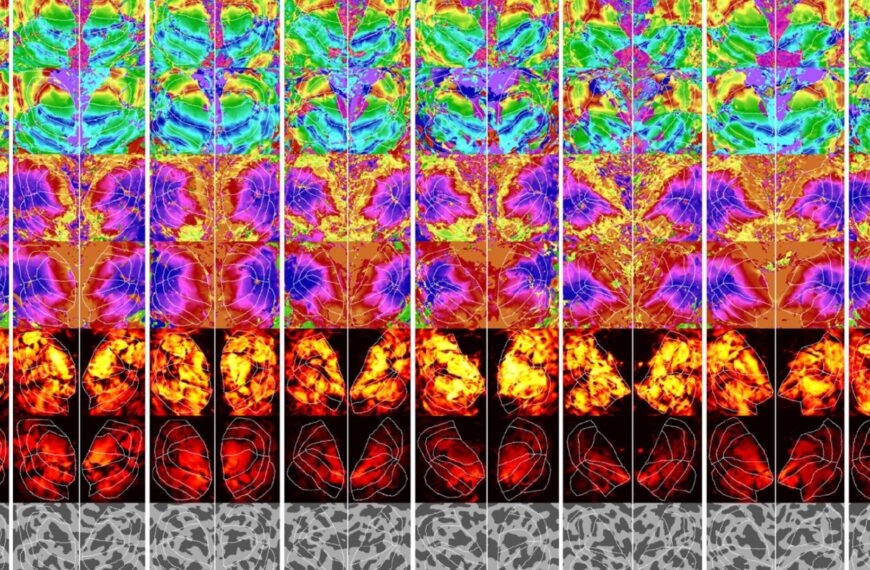 New AI Can Figure Out What You’re Thinking About From a Brain Scan